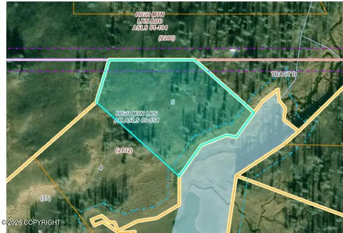 L5 High Mountain Lakes, Matanuska Susitna, AK 99000 - #1