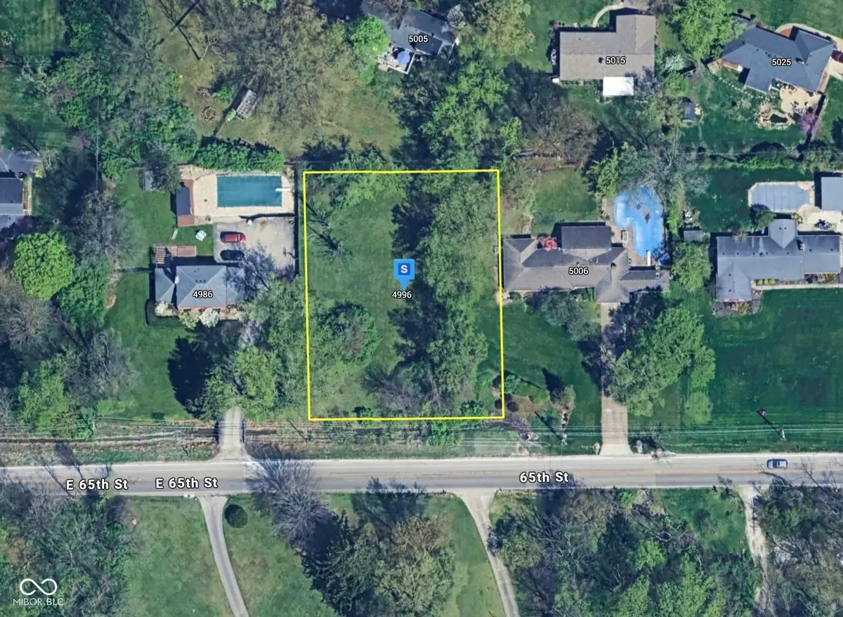 4996 E 65th Street, Indianapolis, IN 46220 - #1