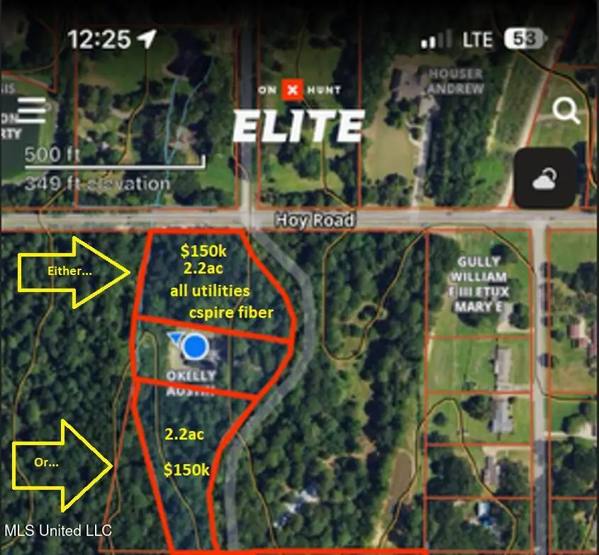 Christmas Lane, Madison, MS 39110 - #1