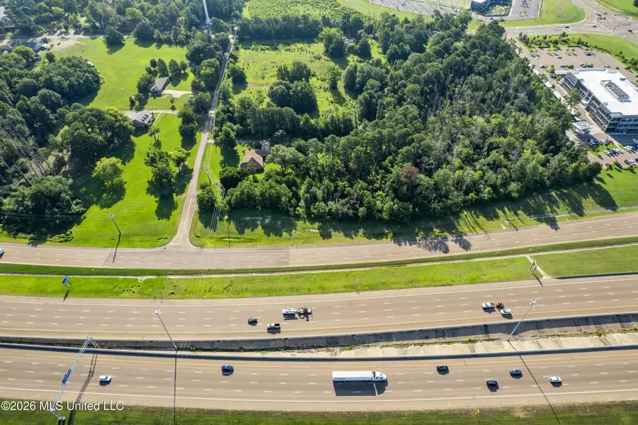 Interstate 55 North Frontage Road, Ridgeland, MS 39157 - #3
