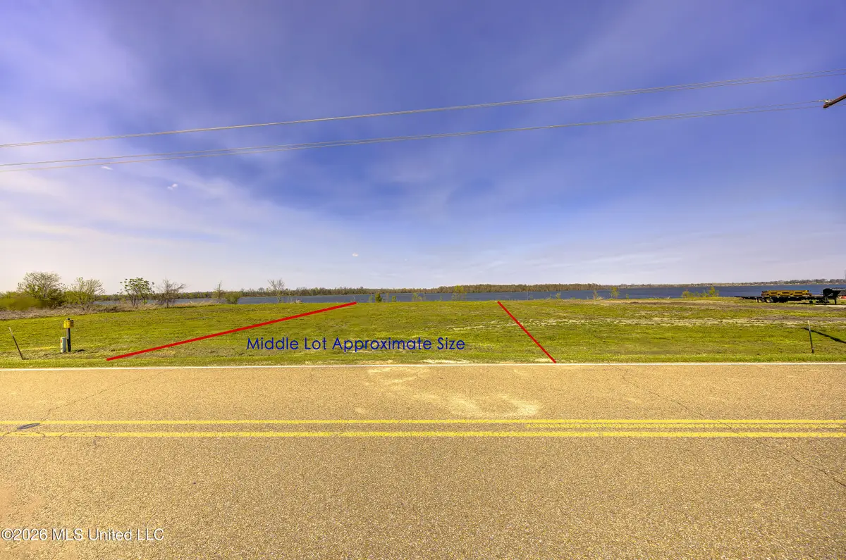2418 Eagle Lake Shore Road, Vicksburg, MS 39183 - #1