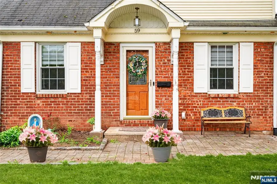 59 Colonial Parkway, Dumont, NJ 07628 - #2