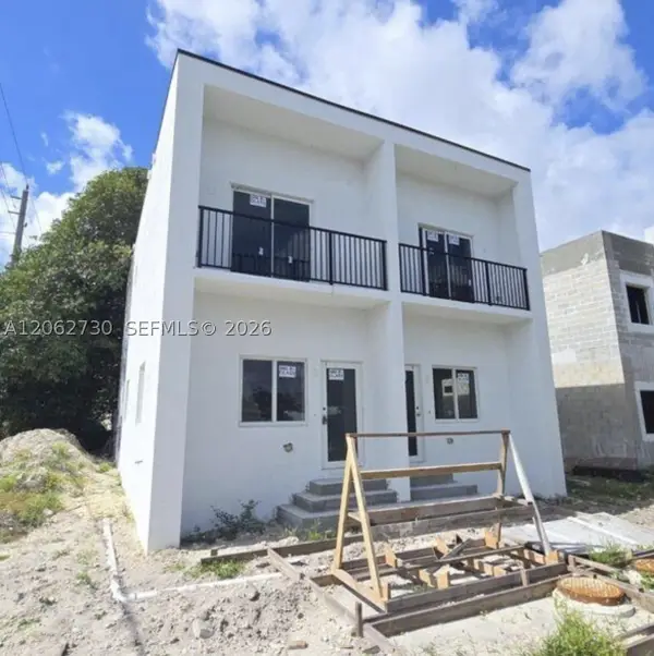 394 NE 174th St, North Miami Beach, FL 33162